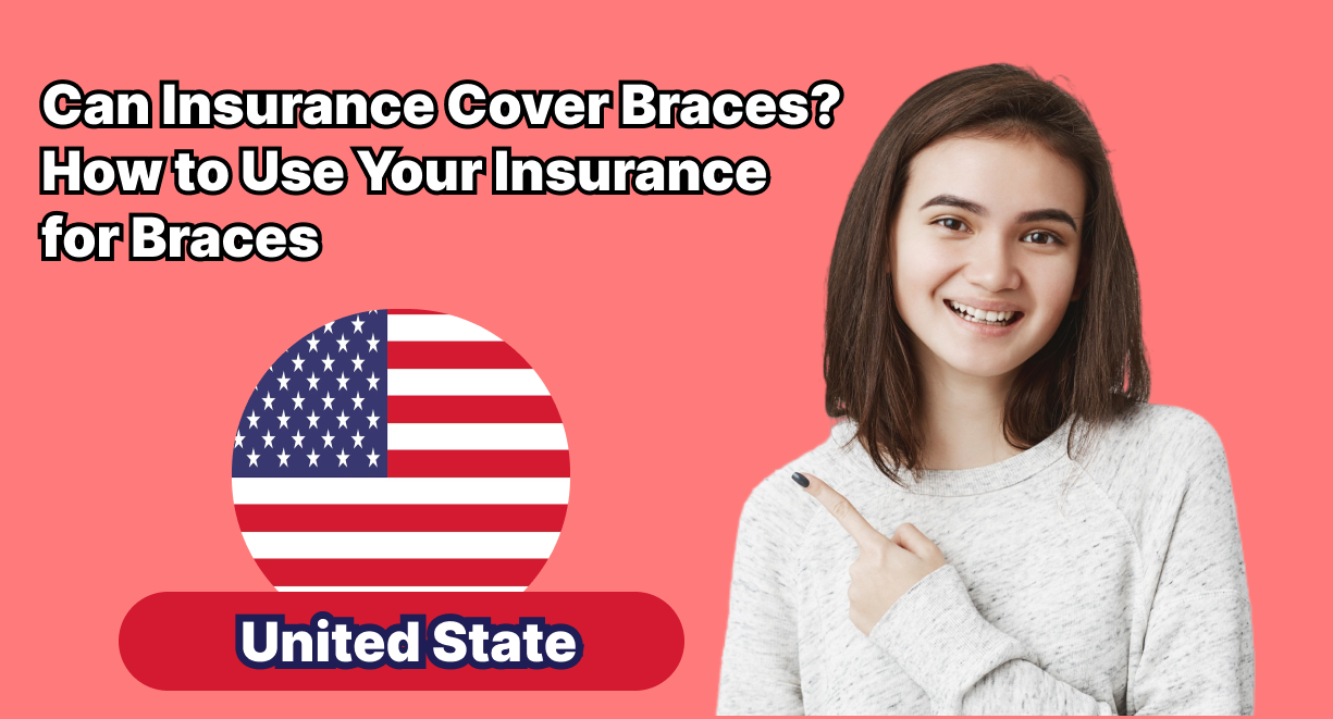 Can Insurance Cover Braces? How to Use Your Insurance for Braces